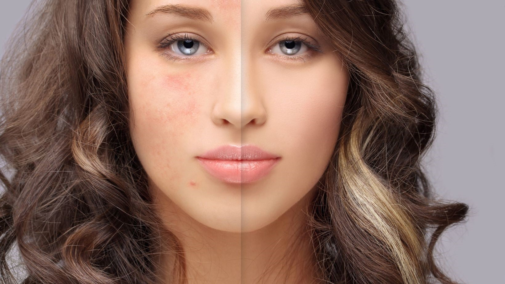 ZENii Rejuvenating Acne Facial